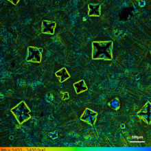  צילום של ליפוזומים המכילים ננו חלקיקי זהב שהוצמדו לחומרים פלורוסצנטיים